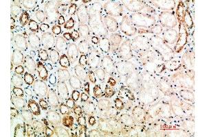 Immunohistochemical analysis of paraffin-embedded human-kidney, antibody was diluted at 1:200 (CTLA4 antibody  (AA 41-90))
