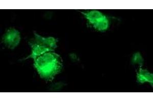 Anti-FBXO21 mouse monoclonal antibody (ABIN2455305) immunofluorescent staining of COS7 cells transiently transfected by pCMV6-ENTRY FBXO21 (RC223095). (FBXO21 antibody)