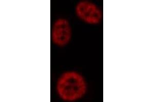 ABIN6276948 staining HepG2? (PAD4 antibody  (N-Term))