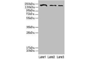 Western blot All lanes: CLTCL1 antibody at 2 μg/mL Lane 1: Jurkat whole cell lysate Lane 2: NIH/3T3 whole cell lysate Lane 3: A431 whole cell lysate Secondary Goat polyclonal to rabbit IgG at 1/10000 dilution Predicted band size: 188, 181 kDa Observed band size: 188 kDa (CLTCL1 antibody  (AA 1423-1566))