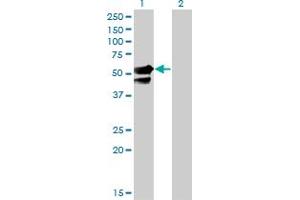 Western Blot analysis of AAK1 expression in transfected 293T cell line by AAK1 monoclonal antibody (M02), clone 4B10. (AAK1 antibody  (AA 315-415))