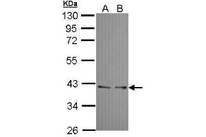 WB Image Sample (30 ug of whole cell lysate) A: A431 , B: H1299 10% SDS PAGEantibody diluted at 1:10000