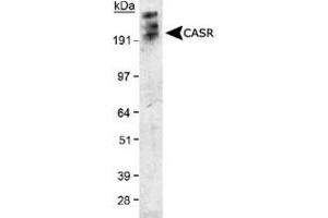 Detection of CASR in transfected 293 cell lysate using CASR monoclonal antibody, clone HL 1499 .