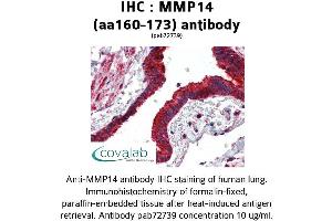 Image no. 1 for anti-Matrix Metallopeptidase 14 (Membrane-inserted) (MMP14) (AA 160-173) antibody (ABIN2852383) (MMP14 antibody  (AA 160-173))