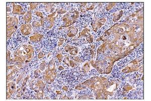 IHC analysis of DHPS/DHS using anti-DHPS/DHS antibody (ABIN7601998).