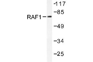 Image no. 1 for anti-V-Raf-1 Murine Leukemia Viral Oncogene Homolog 1 (RAF1) antibody (ABIN271937) (RAF1 antibody)