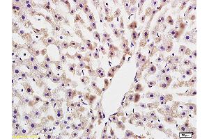 Formalin-fixed and paraffin embedded rat colitis labeled with Anti COLEC10(LIVER) Polyclonal Antibody, Unconjugated (ABIN872637) at 1:200 followed by conjugation to the secondary antibody and DAB staining (COLEC10 antibody  (AA 151-230))