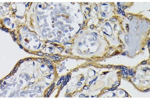Immunohistochemistry of paraffin-embedded Human placenta using IQGAP1 Polyclonal Antibody at dilution of 1:200 (40x lens).