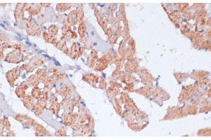 Immunohistochemistry of paraffin-embedded Rat heart using ARRB1 Polyclonal Antibody at dilution of 1:100 (40x lens). (beta Arrestin 1 antibody)