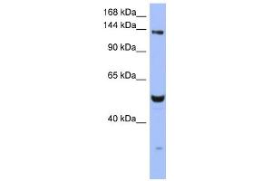 WB Suggested Anti-MSH6 Antibody Titration:  0. (MSH6 antibody  (N-Term))