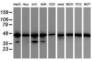 Image no. 1 for anti-Isocitrate Dehydrogenase 1 (NADP+), Soluble (IDH1) antibody (ABIN1502107) (IDH1 antibody)