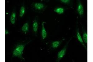 Immunofluorescent staining of HeLa cells using anti-FGF21 mouse monoclonal antibody (ABIN2454474).