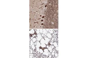 Immunohistochemical staining of human bone marrow with KIF4A polyclonal antibody  shows strong nuclear positivity in hematopoietic cells at 1:50-1:200 dilution.