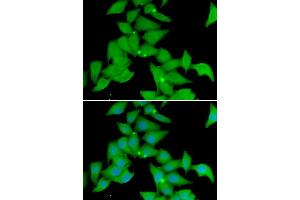 Immunofluorescence analysis of U20S cell using STK3 antibody. (STK3 antibody)