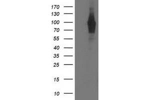 HEK293T cells were transfected with the pCMV6-ENTRY control (Left lane) or pCMV6-ENTRY PDE4B (Right lane) cDNA for 48 hrs and lysed. (PDE4B antibody)