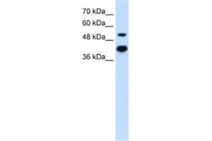 Western Blotting (WB) image for anti-Matrix Metallopeptidase 1 (Interstitial Collagenase) (MMP1) antibody (ABIN2462518) (MMP1 antibody)