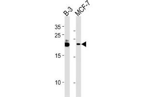 Western Blotting (WB) image for anti-Chromosome 13 Open Reading Frame 30 (C13orf30) antibody (ABIN3004687) (C13orf30 antibody)