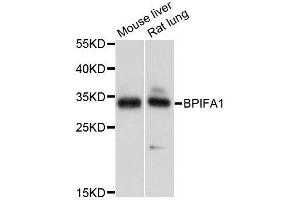 Western blot analysis of extracts of various cell lines, using BPIFA1 antibody (ABIN5995800) at 1/1000 dilution.