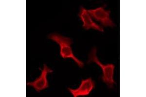 ABIN6276906 staining HuvEc by IF/ICC. (IL-10RA antibody  (C-Term))
