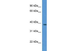 WB Suggested Anti-VASP Antibody Titration: 1. (VASP antibody  (C-Term))