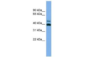 WB Suggested Anti-FGL2 Antibody Titration: 0. (FGL2 antibody  (Middle Region))