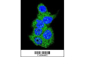 Confocal immunofluorescent analysis of Aldolase (ALDOA) Antibody with HepG2 cell followed by Alexa Fluor 488-conjugated goat anti-rabbit lgG (green). (Aldolase antibody  (N-Term))