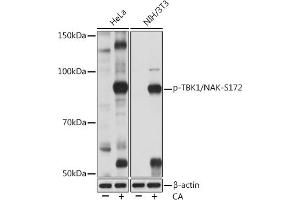 Western blot analysis of extracts of various cell lines, using Phospho-TBK1/NAK-S172 Rabbit mAb (ABIN7270721) at 1:1000 dilution. (TBK1 antibody  (pSer172))