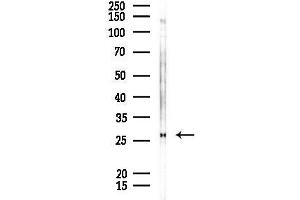 anti-Glutathione S-Transferase alpha 4 (GSTA4) (N-Term) antibody