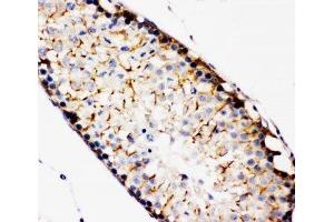 IHC-P: TBK1 antibody testing of rat testis tissue (TBK1 antibody  (C-Term))