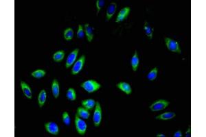 Immunofluorescent analysis of A549 cells using ABIN7163589 at dilution of 1:100 and Alexa Fluor 488-congugated AffiniPure Goat Anti-Rabbit IgG(H+L) (CD42a antibody  (AA 17-88))
