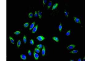 Immunofluorescent analysis of A549 cells using ABIN7163589 at dilution of 1:100 and Alexa Fluor 488-congugated AffiniPure Goat Anti-Rabbit IgG(H+L) (CD42a antibody  (AA 17-88))