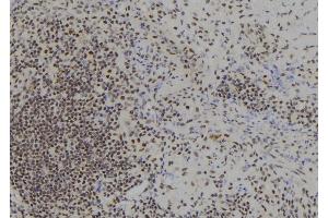 ABIN6278307 at 1/100 staining Human spleen tissue by IHC-P. (BACH1 antibody  (Internal Region))