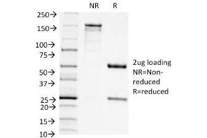 SDS-PAGE (SDS) image for anti-Integrin, alpha X (Complement Component 3 Receptor 4 Subunit) (ITGAX) (AA 637-827) antibody (ABIN6939818)