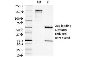 SDS-PAGE Analysis Purified CD11c Mouse Monoclonal Antibody (ITGAX/1242). (CD11c antibody  (AA 637-827))