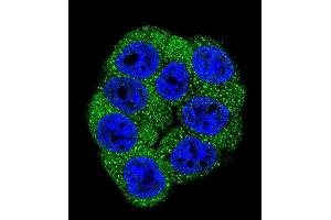 Confocal immunofluorescent analysis of Fructose 6 Phosphate Kinase (PFKM) Antibody (C-term) (ABIN392749 and ABIN2842203) with Hela cell followed by Alexa Fluor 488-conjugated goat anti-rabbit lgG (green). (PFKM antibody  (C-Term))