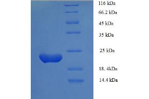 SDS-PAGE (SDS) image for Zinc Finger Protein GLI1 (GLI1) (AA 921-1106), (partial) protein (His tag) (ABIN5712830) (GLI1 Protein (AA 921-1106, partial) (His tag))