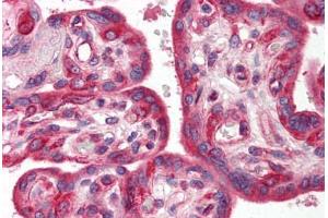 Human Placenta (formalin-fixed, paraffin-embedded) stained with SKIL antibody ABIN214478 at 2. (SKIL antibody  (N-Term))