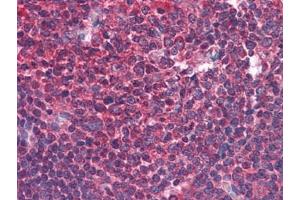 Human Tonsil: Formalin-Fixed, Paraffin-Embedded (FFPE) (BIRC3 antibody)