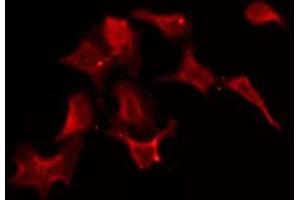 ABIN6275585 staining HuvEc by IF/ICC. (SLC5A3 antibody)