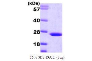 SDS-PAGE (SDS) image for Flavin Reductase (BLVRB) (AA 1-206) protein (ABIN666868)