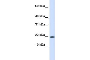 WB Suggested Anti-GABARAPL2 Antibody Titration: 0. (GABARAPL2 antibody  (N-Term))