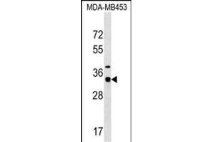 MYOZ2 Antibody (N-term) (ABIN1539381 and ABIN2849046) western blot analysis in MDA-M cell line lysates (35 μg/lane). (MYOZ2 antibody  (N-Term))
