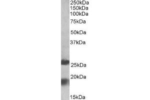 ABIN2563919 (2µg/ml) staining of Human Frontal Cortex lysate (35µg protein in RIPA buffer). (MPV17 antibody  (Internal Region))