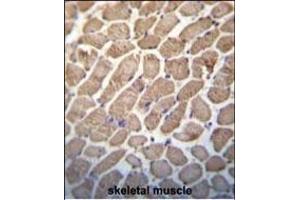 Hamartin (TSC1) Antibody (Center) (ABIN652207 and ABIN2840760) immunohistochemistry analysis in formalin fixed and paraffin embedded human skeletal muscle followed by peroxidase conjugation of the secondary antibody and DAB staining. (TSC1 antibody  (AA 401-430))