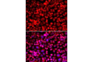 Immunofluorescence analysis of A549 cells using ANLN antibody (ABIN5973909). (Anillin antibody)