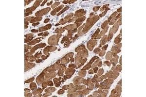 Immunohistochemistry (Formalin/PFA-fixed paraffin-embedded sections) of human heart muscle with MYH7 polyclonal antibody  shows strong cytoplasmic positivity in myocytes. (MYH7 antibody)