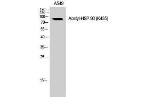Western Blotting (WB) image for anti-Heat Shock Protein 90 (HSP90) (acLys435) antibody (ABIN3172836) (HSP90 antibody  (acLys435))