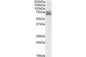 Western Blotting (WB) image for anti-Tripeptidyl Peptidase I (TPP1) (Internal Region) antibody (ABIN2464251) (TPP1 antibody  (Internal Region))
