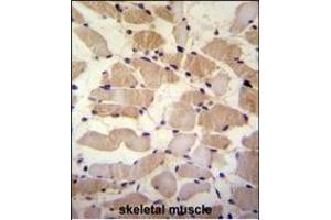 SUSD5 Antibody (C-term) (ABIN655447 and ABIN2844977) immunohistochemistry analysis in formalin fixed and paraffin embedded human skeletal muscle followed by peroxidase conjugation of the secondary antibody and DAB staining. (SUSD5 antibody  (C-Term))