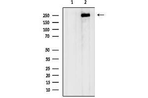 anti-Aggrecan (ACAN) (N-Term) antibody